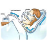 CPAP | BIPAP апарати